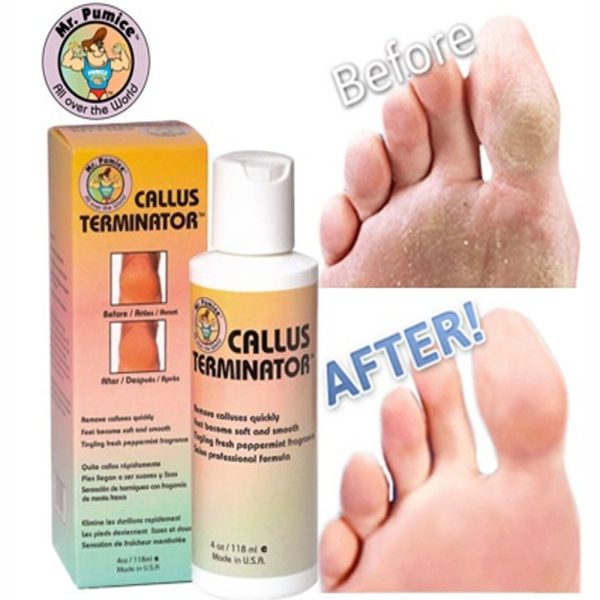 callus-terminatore